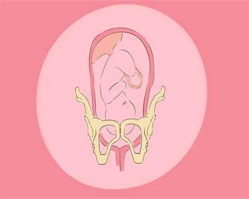 代孕孩子怎么养_通过代孕获得龙凤胎_子宫肌瘤患者是否能做试管？
